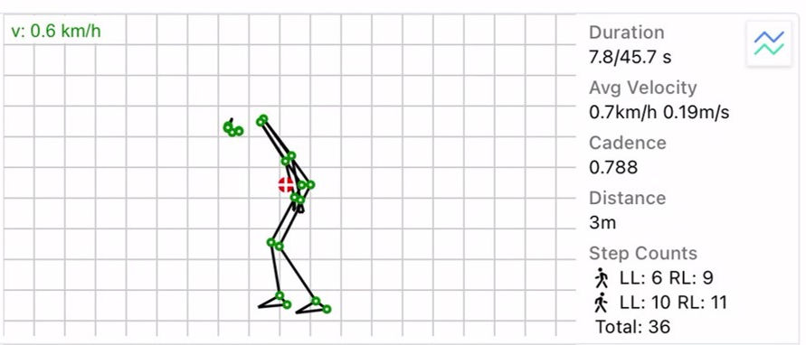 <div class='lum-box'><h4 class='fontColor_blue lum-font-size'>Motion Matrix</h4></div><div class='lum-font-cnt'>Visualization Tool for Walking Motion Rehabilitation Effectiveness
Simply film walking and other movements with a tablet or smartphone and upload the video to the server for three-dimensional movement analysis.</div>