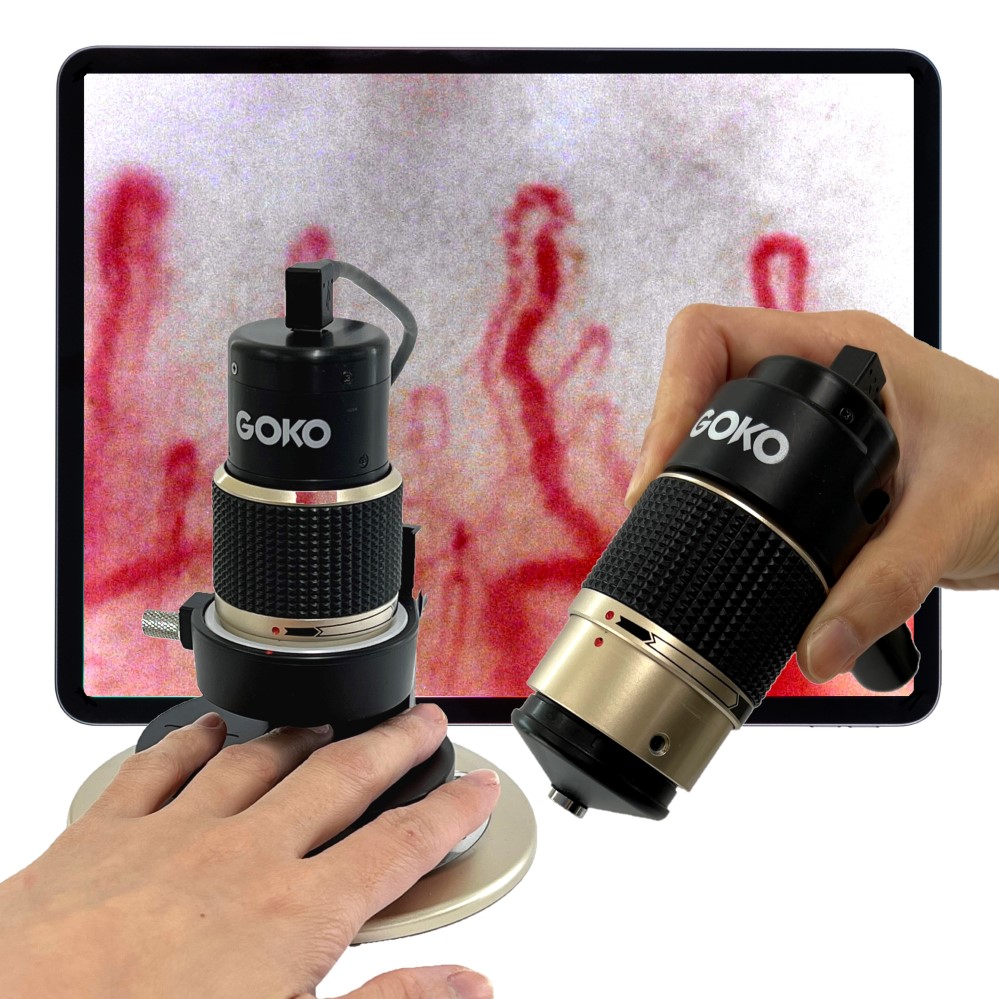 <div class='lum-box'><h4 class='fontColor_blue lum-font-size'>Capillaroscope GOKO Bscan-ZD（USB model）for whole-body</h4>
         </div>
         <div class='lum-font-cnt'>Discover the astounding 720x magnification powered by GOKO's groundbreaking non-reflective technology! This hybrid model offers the flexibility of both dedicated stand and handheld viewing in a single, seamless unit. Effortlessly switch to low magnification in just one second. Ideal for evaluating beauty and health effects, our optional analysis software enables precise quantification of diverse data. Backed by 70 years of optical innovation, GOKO oversees every step from development to manufacturing and sales, delivering unmatched quality and reliability.</div>