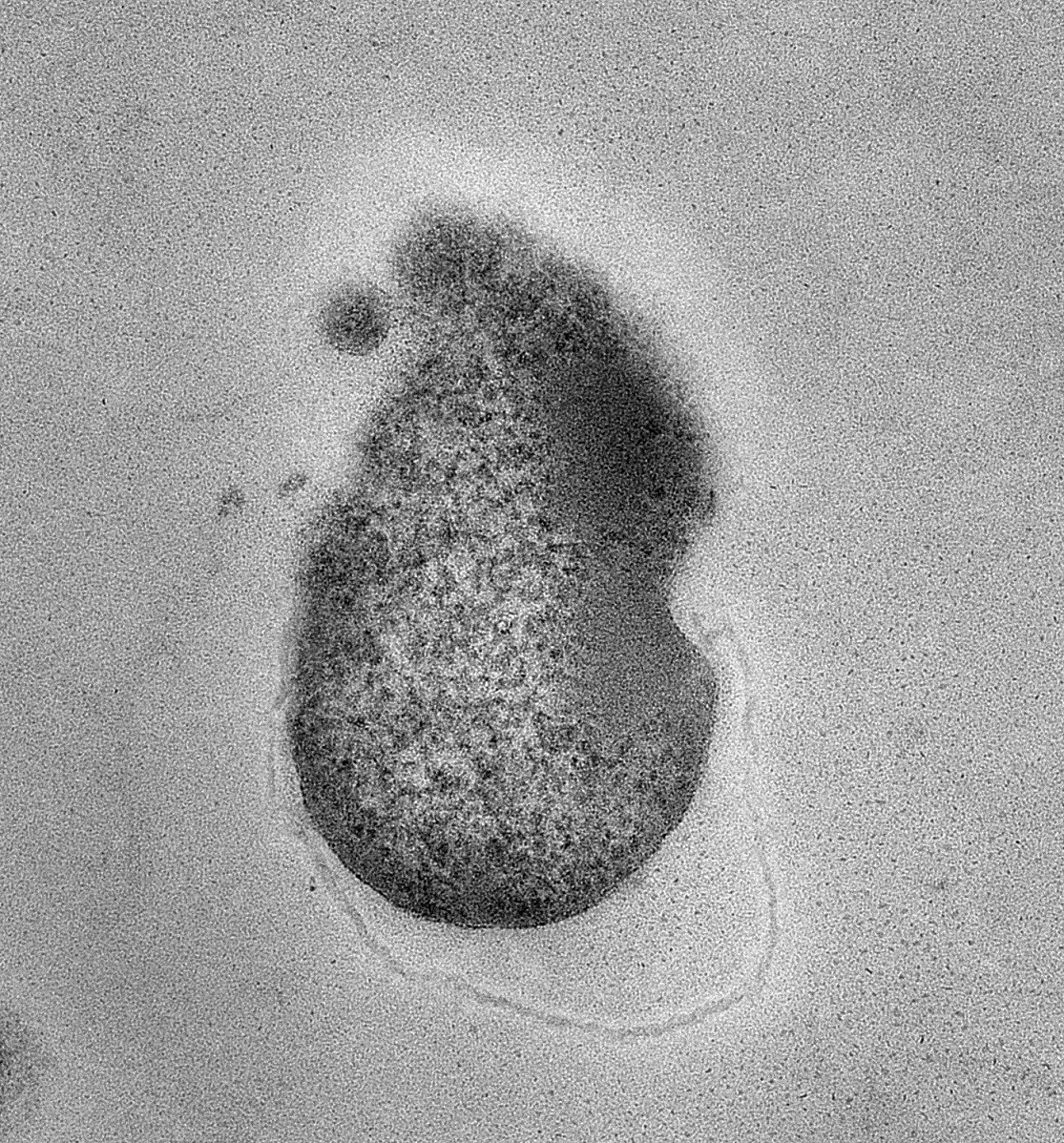 <div class='lum-box'><h4 class='fontColor_blue lum-font-size'>Heat-treated lactic acid bacteria substance　LFK</h4></div>
        	 	<div class='lum-font-cnt'>Inside the hard cell walls of lactic acid bacteria are nucleic acids, minerals, vitamins, and proteins. LFK is processed by enzymatically dissolving this cell wall so that the active ingredients inside the bacteria can work more efficiently.</div>