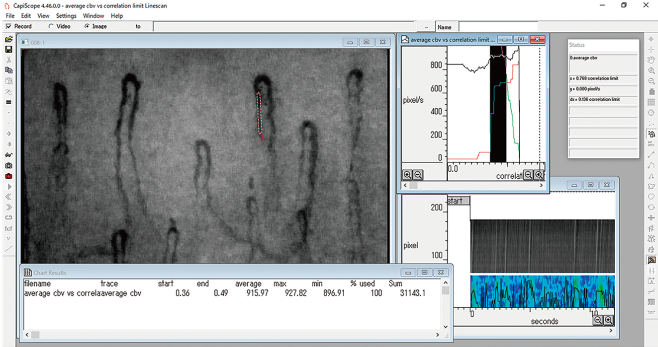 <div class='lum-box'><h4 class='fontColor_blue lum-font-size'>vascular blood flow image analysis software Capimetrics</h4></div>
        	 	<div class='lum-font-cnt'>We deal with vascular blood flow image analysis software, which is mainly for research and development. (More than 130 publications) It captures 60 frames per second for accurate analysis. The high-speed image stabilization function enables analysis as long as there is no significant motion blur. Flow velocity, diameter, density, and length can be analyzed.</div>