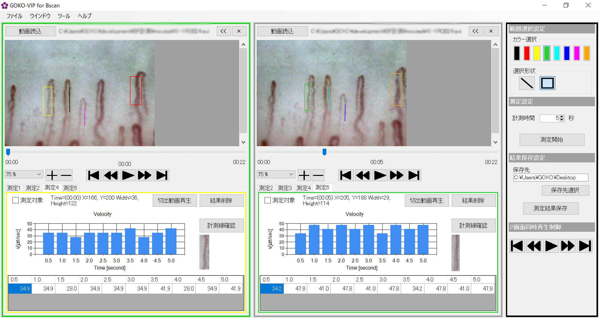 <div class='lum-box'><h4 class='fontColor_blue lum-font-size'>Blood-flow measurement software "GOKO-VIP"</h4></div>
        		 <div class='lum-font-cnt'>GOKO introduces a revolutionary application that quantifies flow velocity, providing precise numerical data for what was previously assessed subjectively as "faster" or "slower." Developed in response to the demand for a capillary-optimized flow velocity measurement application, it significantly contributes to clinical research, evidence gathering, and evaluation across various medical, beauty, and health domains.</div>