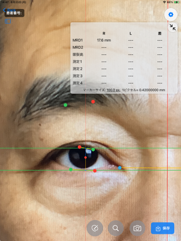 <div class='lum-box'><h4 class='fontColor_blue lum-font-size'>眼瞼計測ソフト</h4></div><div class='lum-font-cnt'>北里研究所様との共同研究で開発した撮影した画像から自動で瞼等の寸法を計測するアプリとなります
従来の実物大の画像からの定規による計測をアプリが行います</div>