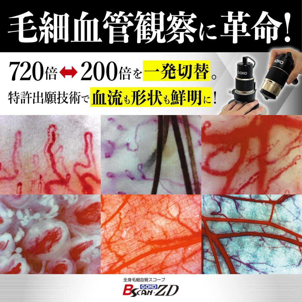 <div class='lum-box'><h4 class='fontColor_blue lum-font-size'>Capillaroscope GOKO Bscan-ZD（USB model）for whole-body</h4>
         </div>
         <div class='lum-font-cnt'>Discover the astounding 720x magnification powered by GOKO's groundbreaking non-reflective technology! This hybrid model offers the flexibility of both dedicated stand and handheld viewing in a single, seamless unit. Effortlessly switch to low magnification in just one second. Ideal for evaluating beauty and health effects, our optional analysis software enables precise quantification of diverse data. Backed by 70 years of optical innovation, GOKO oversees every step from development to manufacturing and sales, delivering unmatched quality and reliability.</div>
