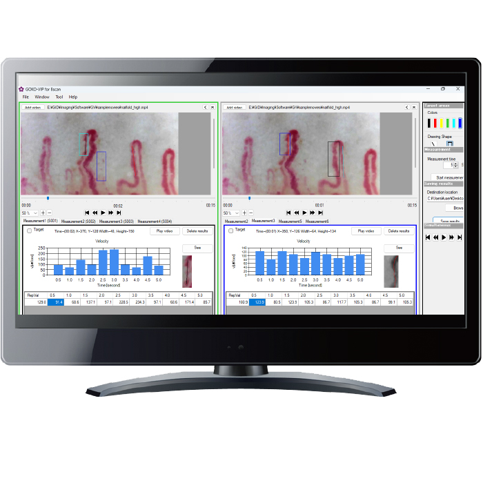 <div class='lum-box'><h4 class='fontColor_blue lum-font-size'>Blood-flow measurement software "GOKO-VIP</h4></div>
        	 	<div class='lum-font-cnt'>GOKO introduces a revolutionary application that quantifies flow velocity, providing precise numerical data for what was previously assessed subjectively as "faster" or "slower." Developed in response to the demand for a capillary-optimized flow velocity measurement application, it significantly contributes to clinical research, evidence gathering, and evaluation across various medical, beauty, and health domains.</div>