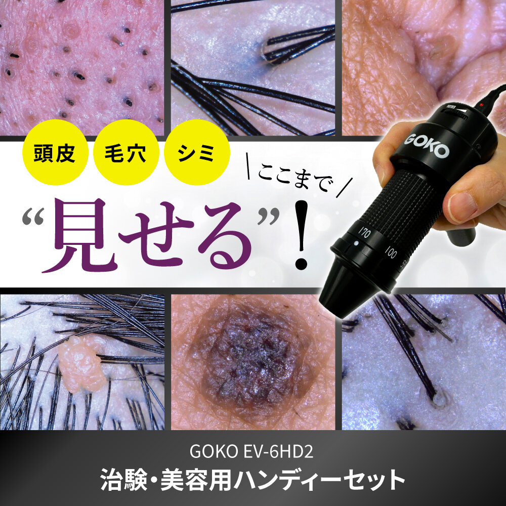 <div class='lum-box'><h4 class='fontColor_blue lum-font-size'>Multi-distance scope GOKO EV-6HD2</h4></div>
        		<div class='lum-font-cnt'>The GOKO EV-6HD2 combines advanced optics and imaging into a single, compact unit ― ideal for everything from distant views to ultra-close macros. Its handheld and mountable flexibility and up to 170× magnification make it a trusted tool across professional fields.　Suitable for four different usage scenarios, including medical testing, beauty, and laboratory use.</div>